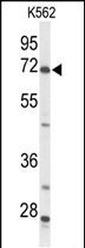 ACSS2 Antibody (N-term)