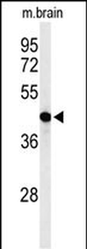 AGPAT6 Antibody (N-term)