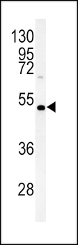 DGAT2 Antibody (N-term)