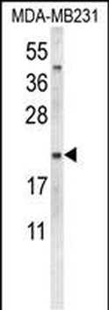 NEU1 Antibody (Center)