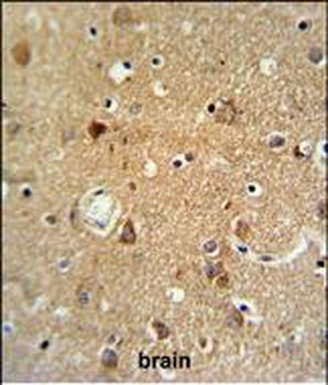 NEU1 Antibody (Center)
