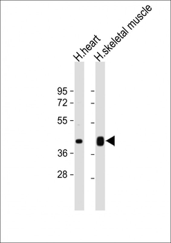 PD L1 Antibody (C-Term)