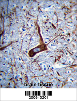 MAP2 Antibody (Ascites)