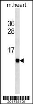 Cardiac FABP Antibody(Ascites)