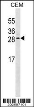 EPO Antibody (Ascites)
