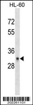 CD40 Antibody (C-term) (Ascites)