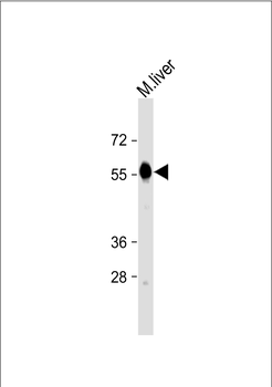 CAT Antibody (Center) (Ascites)