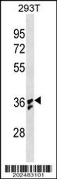 IL1B Antibody (Center) (Ascites)