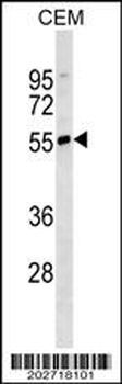 IGHD Antibody (N-term) (Ascites)
