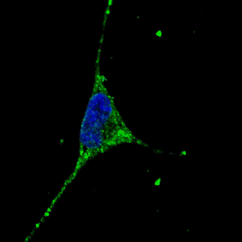 PODXL Antibody (C-term) (Ascites)