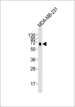 CD73(NT5E) Antibody (C-term)