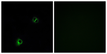 FZD9 Antibody