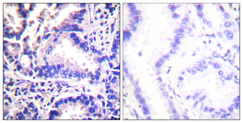 Synuclein γ Antibody