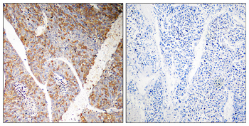 BAG3 Antibody