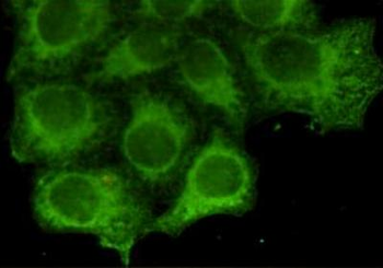 Keratin 18 Antibody