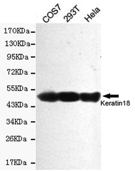 Keratin 18 Antibody