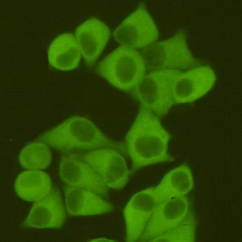 Fatty Acid Synthase Antibody