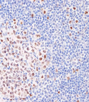 KI67 Mouse mAb Antibody