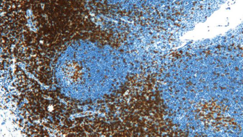 CD3D Antibody
