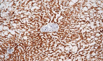 PTGS2 Antibody