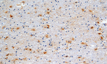 GFAP Antibody