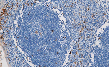 LYZ Antibody