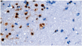 RBFOX3 Antibody