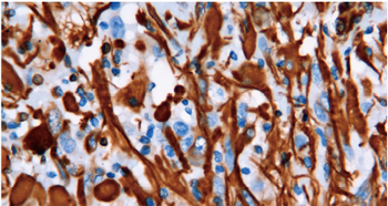 NGFR Antibody