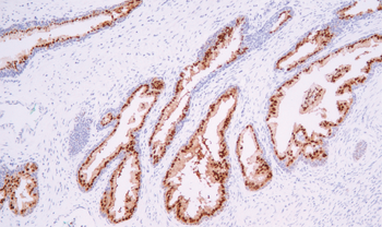 NKX3-1 Antibody
