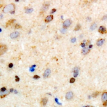 Girdin Antibody