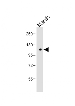 Mouse Cdk13 Antibody (N-term)