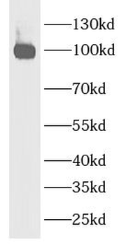 CDH6 Rabbit Polyclonal Antibody