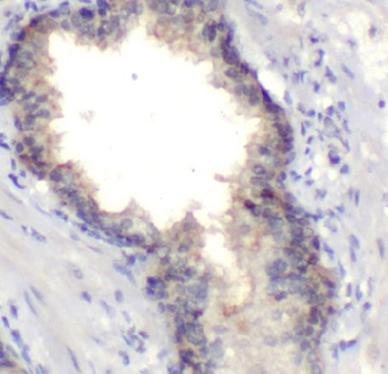 FURIN Rabbit Polyclonal Antibody