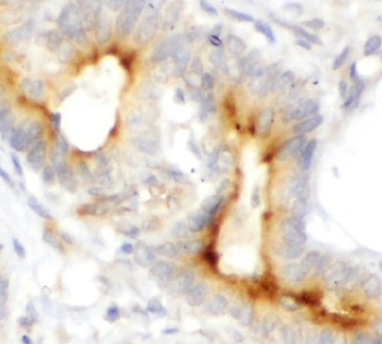 SERPINH1 Rabbit Polyclonal Antibody