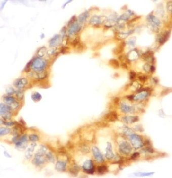 SLC34A2 Rabbit Polyclonal Antibody