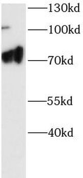 FLCN Rabbit Polyclonal Antibody