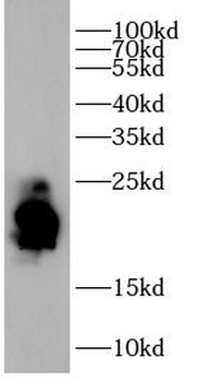 CD3G Rabbit Polyclonal Antibody