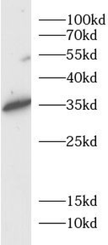 WFDC2 Rabbit Polyclonal Antibody
