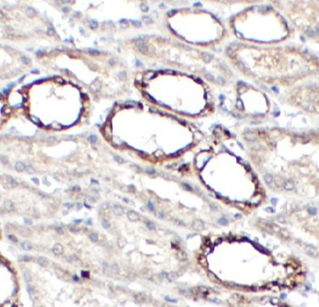 WFDC2 Rabbit Polyclonal Antibody