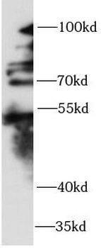 ZNF746 Rabbit Polyclonal Antibody