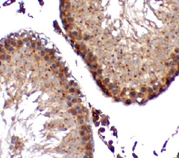 ZNF746 Rabbit Polyclonal Antibody