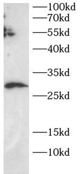 SECTM1 Rabbit Polyclonal Antibody
