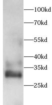 GALC Rabbit Polyclonal Antibody