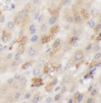 GALC Rabbit Polyclonal Antibody