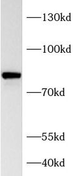 HBS1L Rabbit Polyclonal Antibody