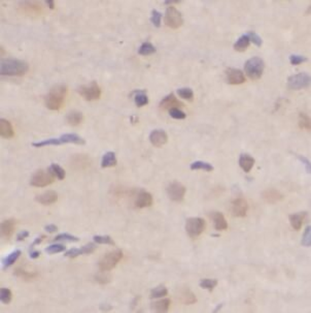 HBS1L Rabbit Polyclonal Antibody