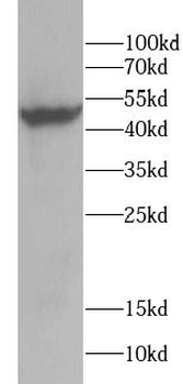 CYP24A1 Rabbit Polyclonal Antibody
