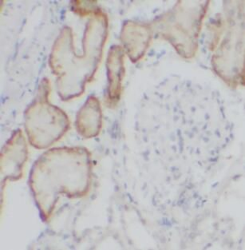 CYP24A1 Rabbit Polyclonal Antibody