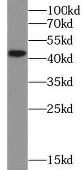 CTSE Rabbit Polyclonal Antibody