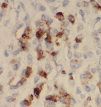 CTSE Rabbit Polyclonal Antibody